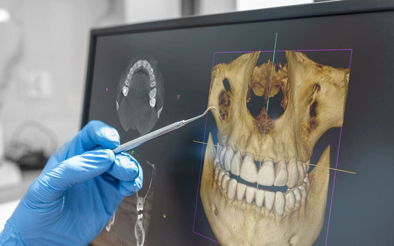 3d-dental-tomografi-3dtomografi
