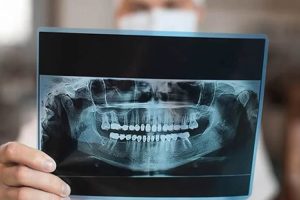 3D Dental Tomografinin Diş Tedavisindeki Rolü ve Avantajları