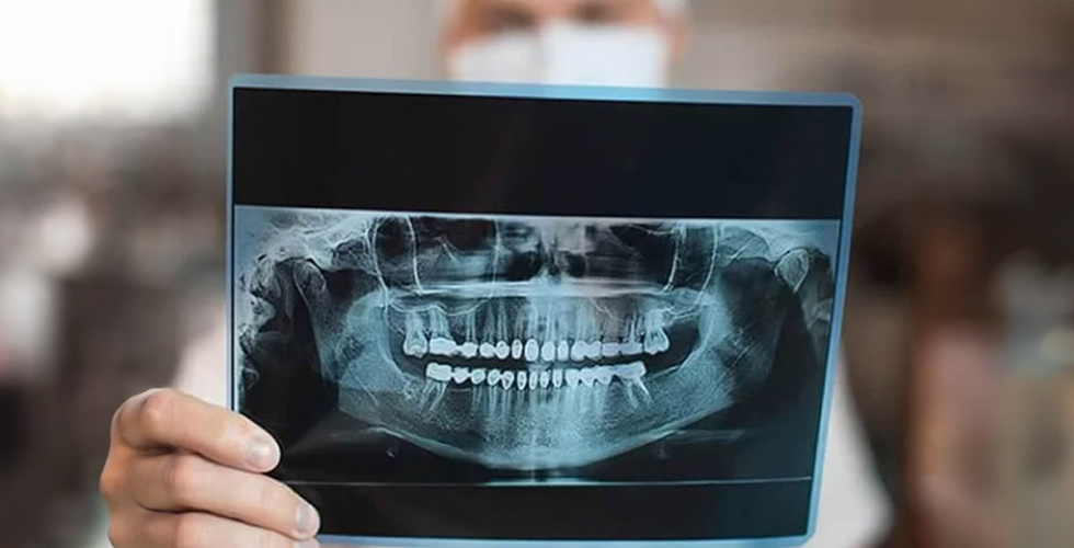 3D Dental Tomografinin Diş Tedavisindeki Rolü ve Avantajları