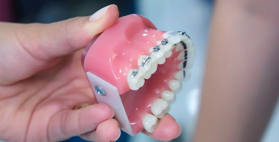 braket-nedir-ve-cesitleri-nelerdir-resim1