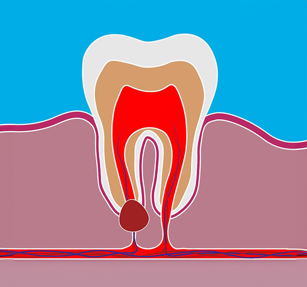 Dental surgery. Tooth implant cut vector illustration. Healthy teeth and dental implant, stomatology poster