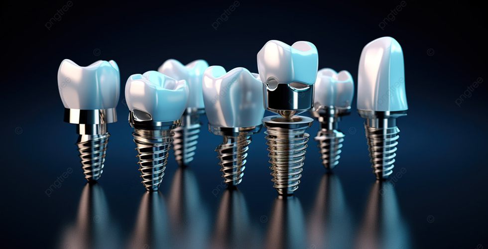 mini-dental-implant-ve-dis-implanti-arasindaki-farklar-resim2