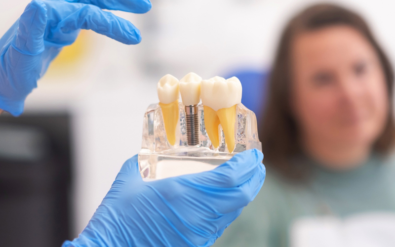 mşnş-dental-implant-tedavi